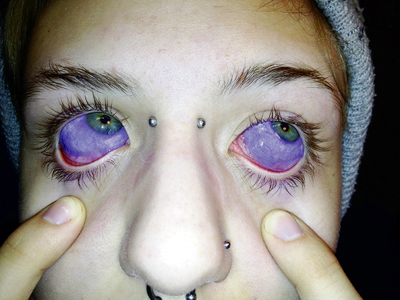 Tatuaggio Agli Occhi Sempre Piu Svizzeri Lo Fanno Ticinonline