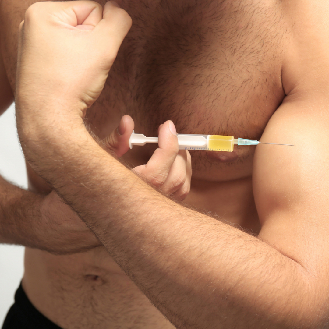 Doping In Ticino C E Chi Si E Iniettato Dosi Per Cavalli E Chi E Morto Ticinonline