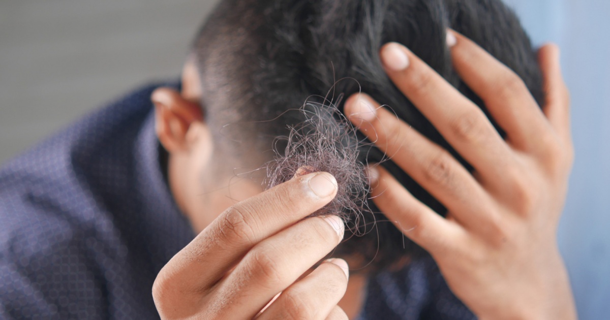 Revolução no Tratamento da Queda de Cabelo: hCRP Sonicato Supera o PRP