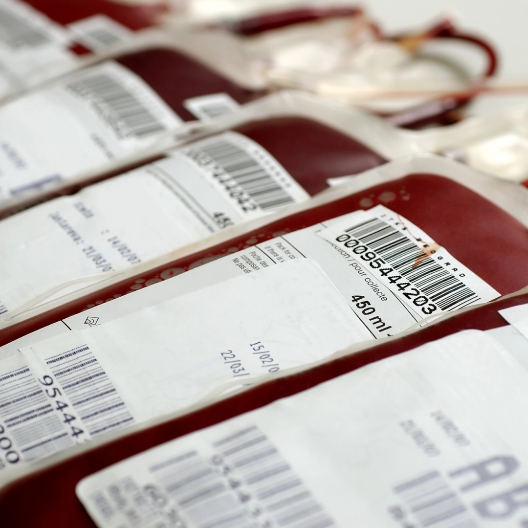 Il caldo prosciuga le donazioni di sangue: «Senza quei donatori oggi non sarei qui»
