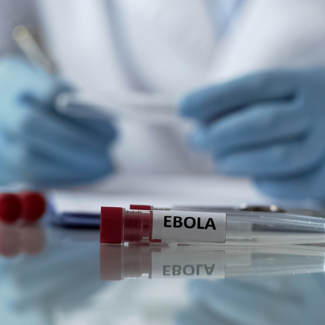 L'ebola continua a diffondersi in Congo, oltre 400 morti