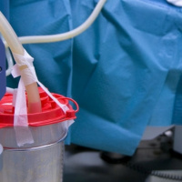 Muore dopo una liposuzione: «Nove mesi di agonia»