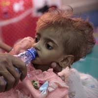 Inferno Yemen: «Qui muore un bimbo ogni dieci minuti»