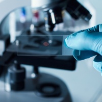 Coronavirus, in Ticino siamo pronti?