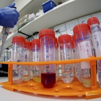 Coronavirus: primo caso negli USA