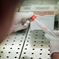 550 volontari per testare il vaccino