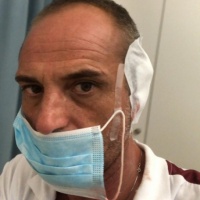 Spintonato a Cham, sette punti di sutura per il magazziniere del Bellinzona
