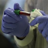 Milioni di dosi di vaccino «entro l'inizio del 2021»