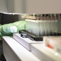 Approvato un nuovo farmaco contro l'Alzheimer, ed è anche un po' svizzero