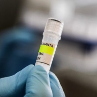 Hantavirus in Svizzera, cosa c'è da sapere