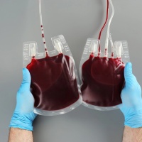 Superata la carenza di sangue 0 negativo negli ospedali ticinesi