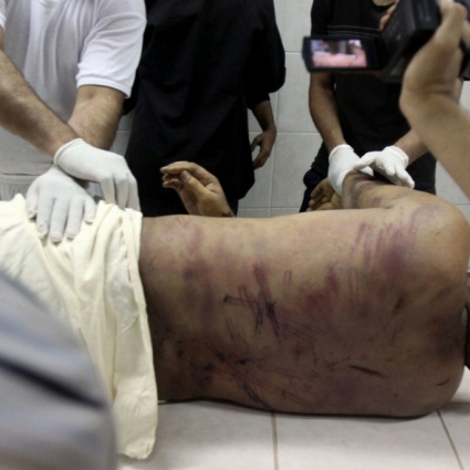 Viaggio nell'inferno delle torture siriane