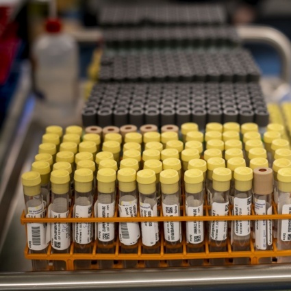 Le “firme” nel sistema immunitario di chi rischia il Long Covid