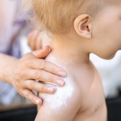 Sole e neonati: i filtri solari sono sicuri?
