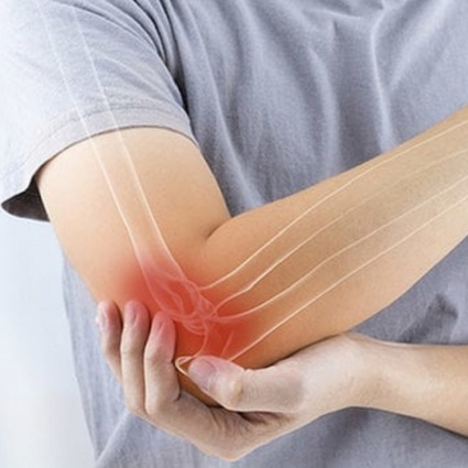 Come continuare ad allenarsi in palestra con l’epicondilite?