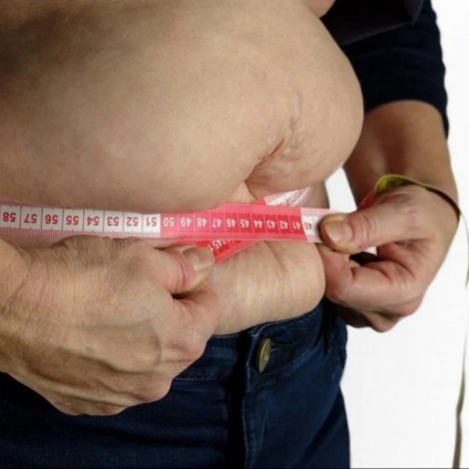Il trattamento che elimina il grasso e rimodella qualunque punto del corpo senza l’uso del bisturi