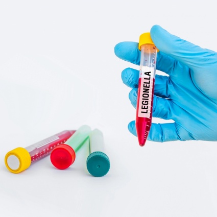 Legionella a Basilea, due nuovi casi