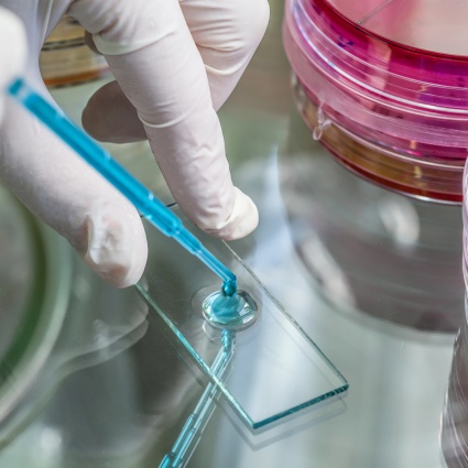 L'epidemia di legionella è terminata