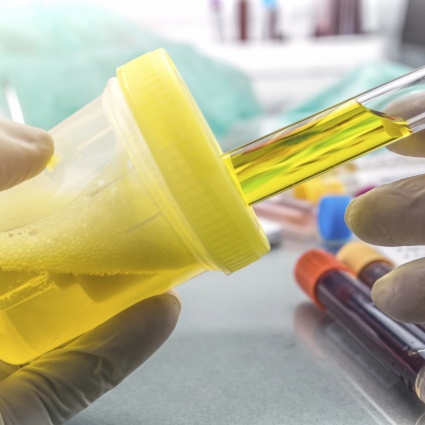 Focolaio eccezionale di Legionella: 26 contagi e un morto a Basilea