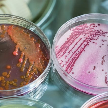 Legionella, ancora cinque ricoverati ma nessun nuovo caso