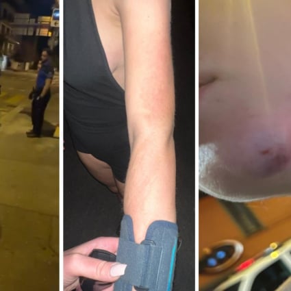 Festa di compleanno finita male: tre ragazze aggredite di notte in pieno centro