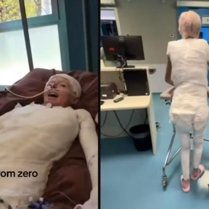 Francesca può camminare di nuovo dopo 200 giorni