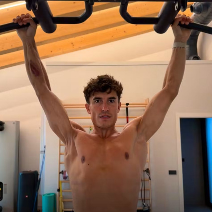 La foto shock di Márquez: «La mia spalla dopo sette operazioni»