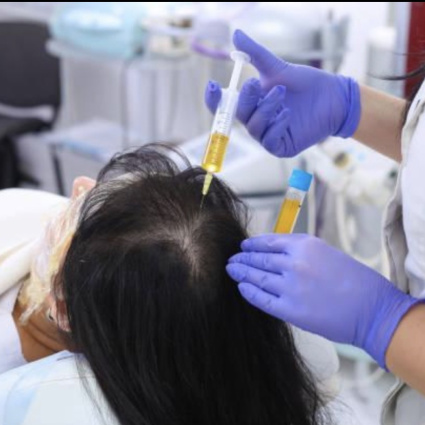 PRP per capelli: cos’è e quando funziona davvero