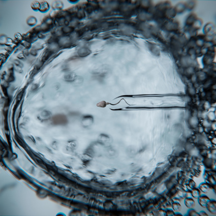 Un figlio in vitro resta un lusso. «Non è rimborsabile, ed è un’ingiustizia»