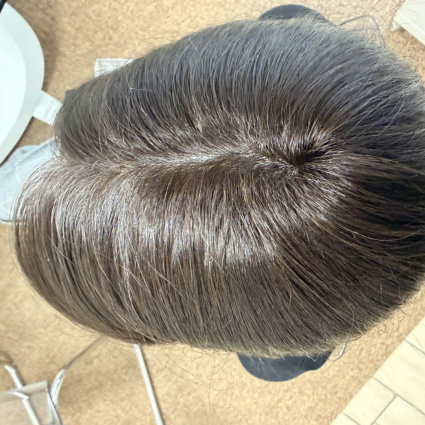 La base della protesi: lace, skin o mono, come scegliere