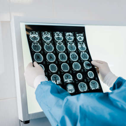 Cancro alla prostata, in Svizzera è buona l'assistenza sanitaria