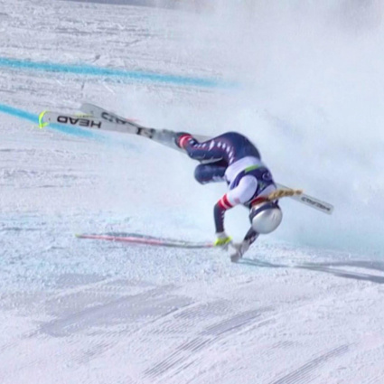 Nuova operazione per Lindsey Vonn: ritorno sempre più lontano