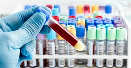 Si cercano 140mila volontari per un test in grado di rilevare il cancro prima che si manifestino i sintomi