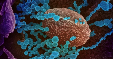 Covid: scoperta la causa dei danni cellulari nella fase acuta