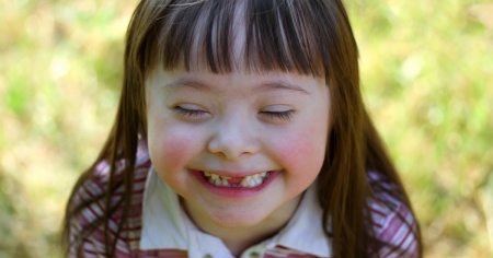 Sindrome di Down: «Non è solo questione di QI o rischi clinici»