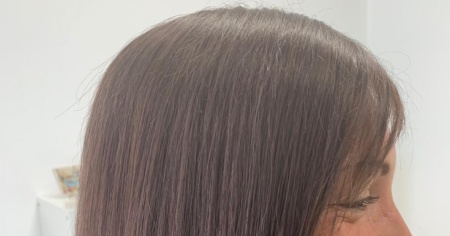 Protesi di capelli: addio al «parrucchino» di una volta