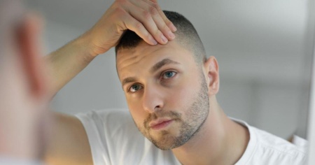 A che età conviene fare un trapianto di capelli?
