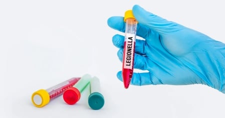 Legionella a Basilea, due nuovi casi