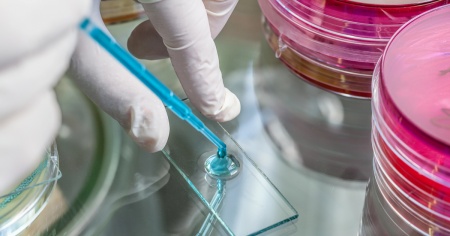 L'epidemia di legionella è terminata