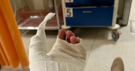 Incidente in scooter per il deputato leghista Andrea Censi: positivo all’alcol test