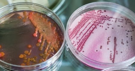 Legionella, ancora cinque ricoverati ma nessun nuovo caso