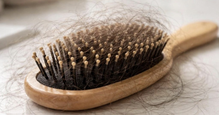 Caduta dei capelli: i primi segnali da non ignorare