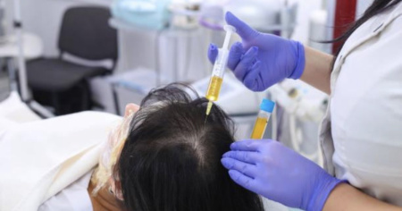 PRP per capelli: cos’è e quando funziona davvero