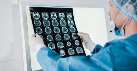 Cancro alla prostata, in Svizzera è buona l'assistenza sanitaria